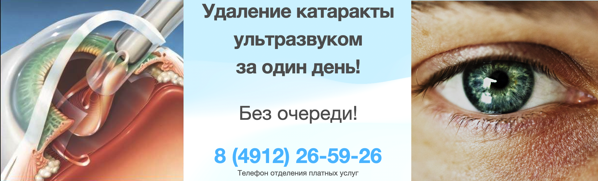 Удаление катаракты за 1 день